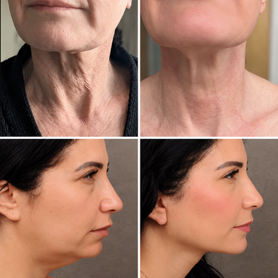 Crema Reafirmante para Cuello con PDRN y Colágeno + Gua Sha